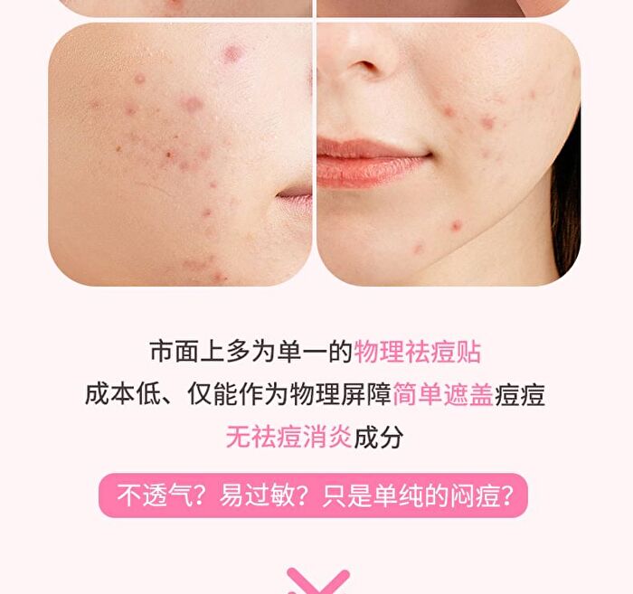 Yaozhi Pure Radiance Acne Pimple Patch - 3 Types - Energy Jelly (36pcs)