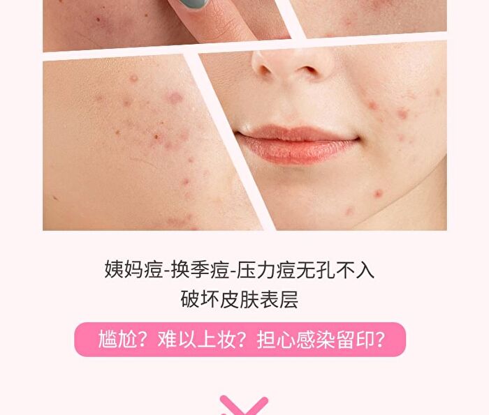 Yaozhi Cute Radiance Acne Pimple Patch (Trial Size)  - 3 Types - Rest Time (12pcs)