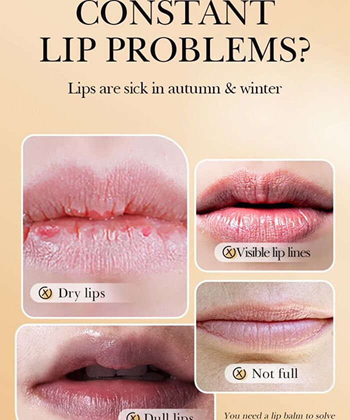 Bioaqua Anti Cracking Lip Balm - 4 Types - #02 Nicotinamide