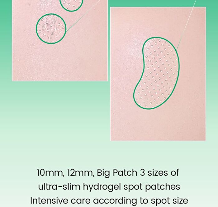No Problem Spot Patch - 72 patches