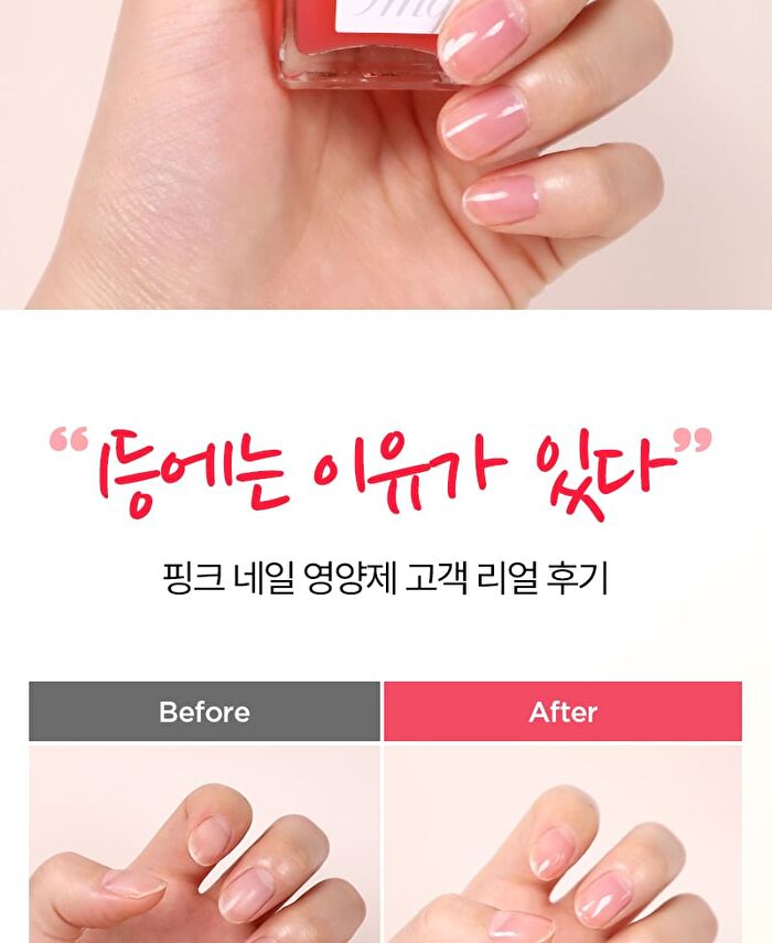 fmgt Repair Nail - 7 Types - #10 Peptide Nail Serum