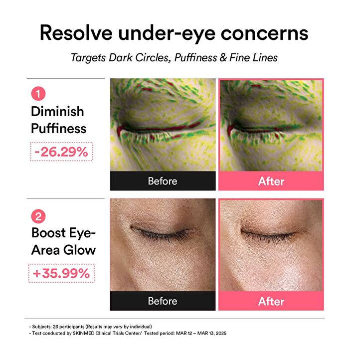 PDRN Retinal Eye Patch Glow Jelly - 60 patches
