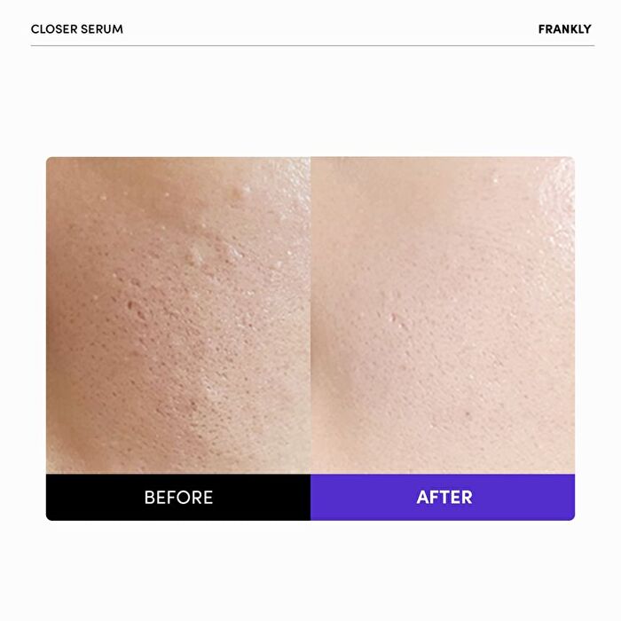 Frankly Closer Pore Reducing Serum Jumbo - 100ml