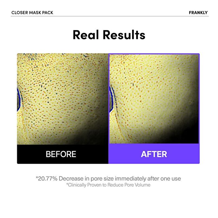 Frankly Closer Pore Minimizing Mask Pack Set - 22ml x 10 sheets