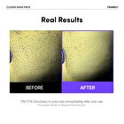 Frankly Closer Pore Minimizing Mask Pack Set - 22ml x 10 sheets