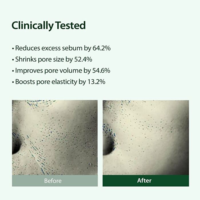 Blithe Targeted Pore Serum Niacinamide 22 - 30ml