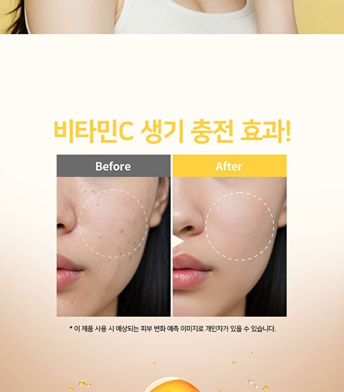 Ootd Dark Spot Vitamin C Toner - 250ml