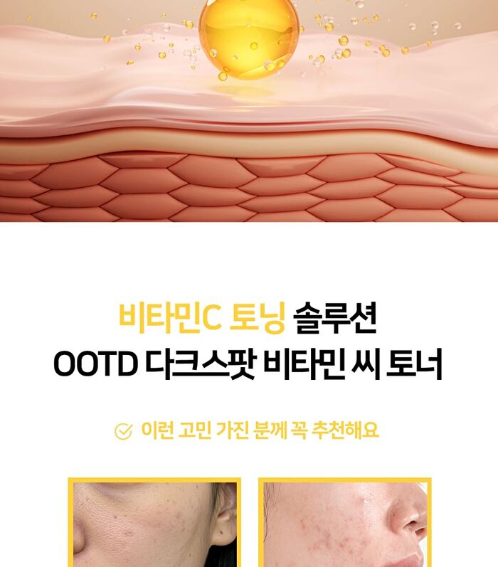 Ootd Dark Spot Vitamin C Toner - 250ml