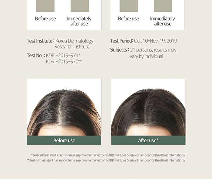 Nard Hair Loss Control Shampoo - 500ml