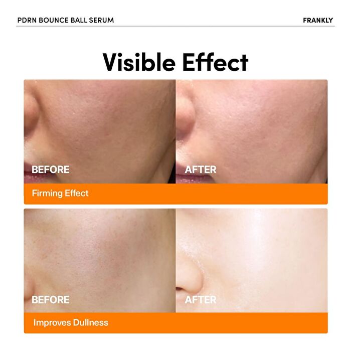 Frankly PDRN Bounce Ball Serum - 30ml