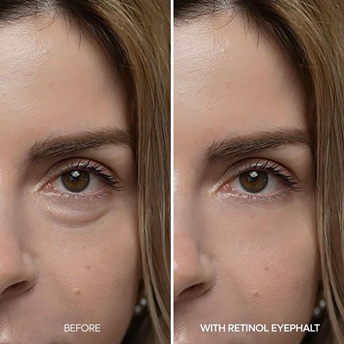 Dr.Melaxin Eyephalt Retinol Eyebag Cream - 10g