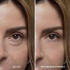 Dr.Melaxin Eyephalt Retinol Eyebag Cream - 10g