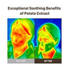 Potato Wash Off Pack - 100g