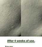 Odeloi Low pH Pore Tightening Nid Soap - 120g