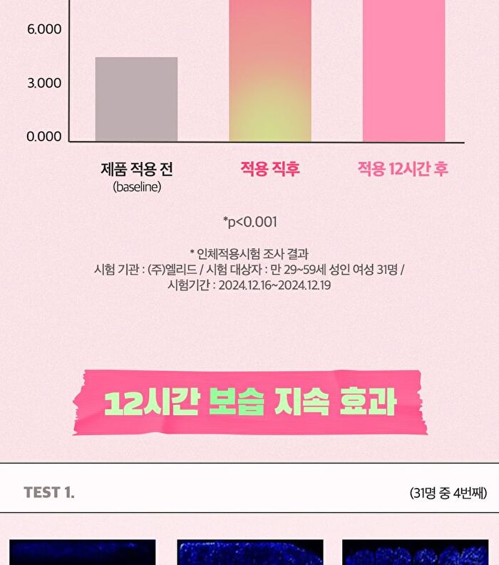 Vitamin B Lip Mask Watermelon - 14g