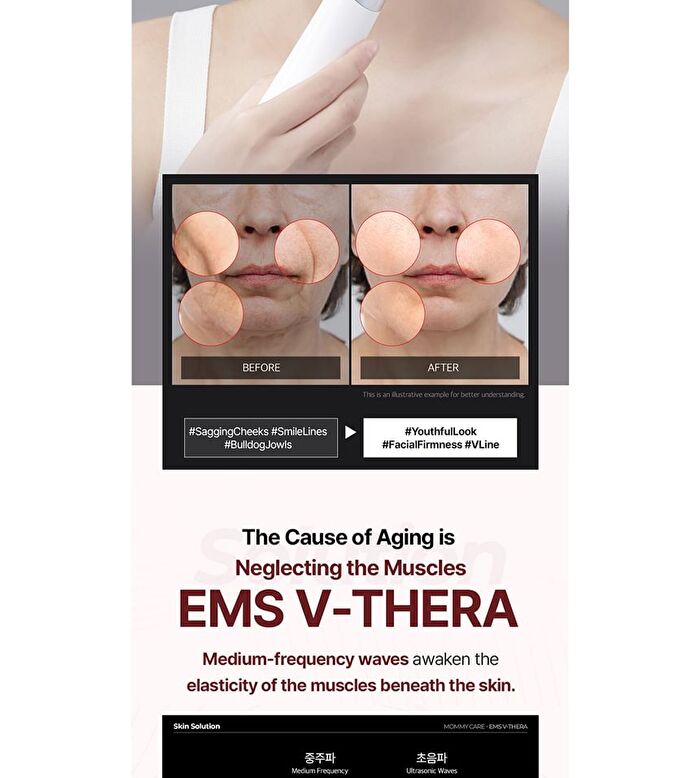 EMS V-THERA - 1 Set