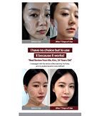 EMS V-THERA Pink Edition - 1 Set