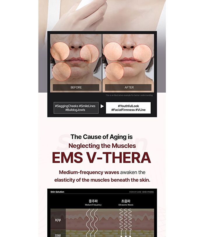 EMS V-THERA Pink Edition - 1 Set