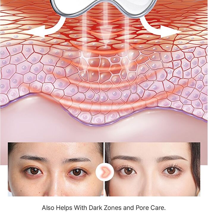 Face Electric Care Massager - 1 Set
