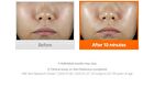 Vita 10 Radiance Sheet Mask Set - 25ml x 5 sheets