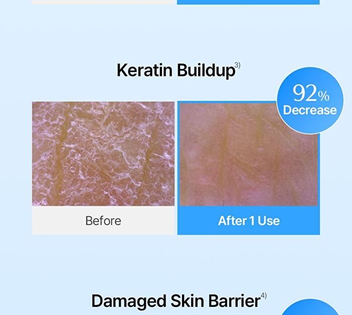 EGF Blue AC Calming Serum - 50g