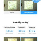 EGF Blue AC Calming Serum - 50g