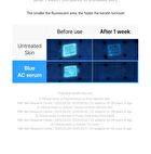 EGF Blue AC Calming Serum - 50g