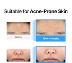 EGF Blue AC Calming Serum - 50g