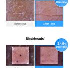 EGF Blue Calming Toner Pad - 60 pads