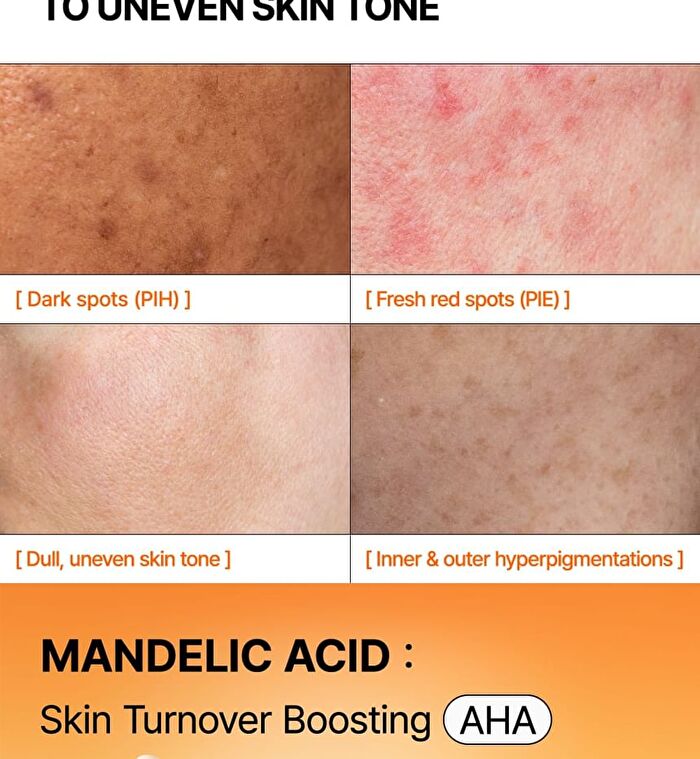 Mandelic Acid Dark Spot Correcting Serum - 30ml
