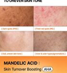 Mandelic Acid Dark Spot Correcting Serum - 30ml