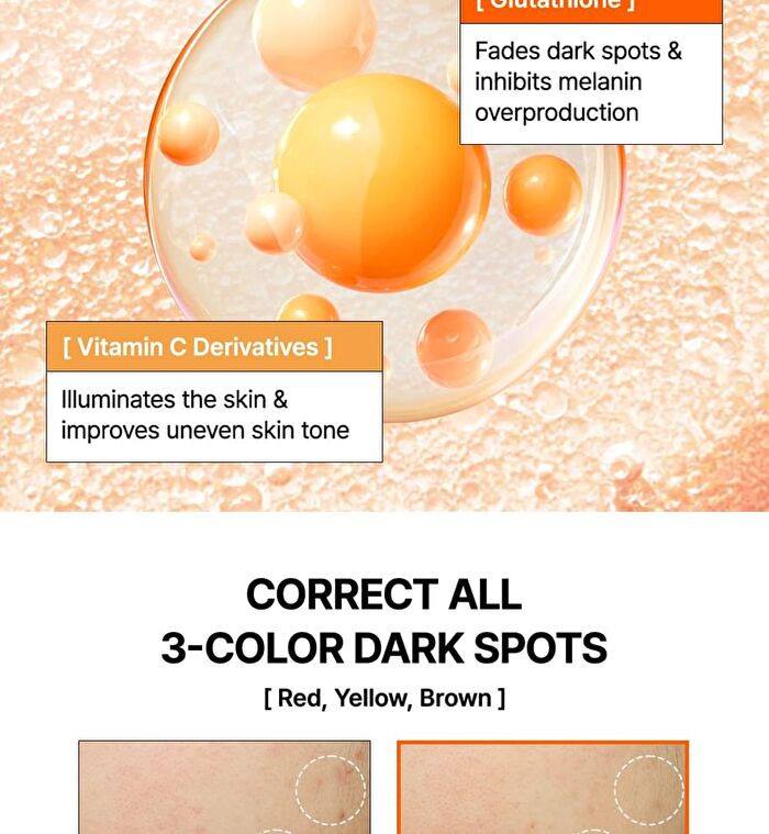 Mandelic Acid Dark Spot Correcting Serum - 30ml