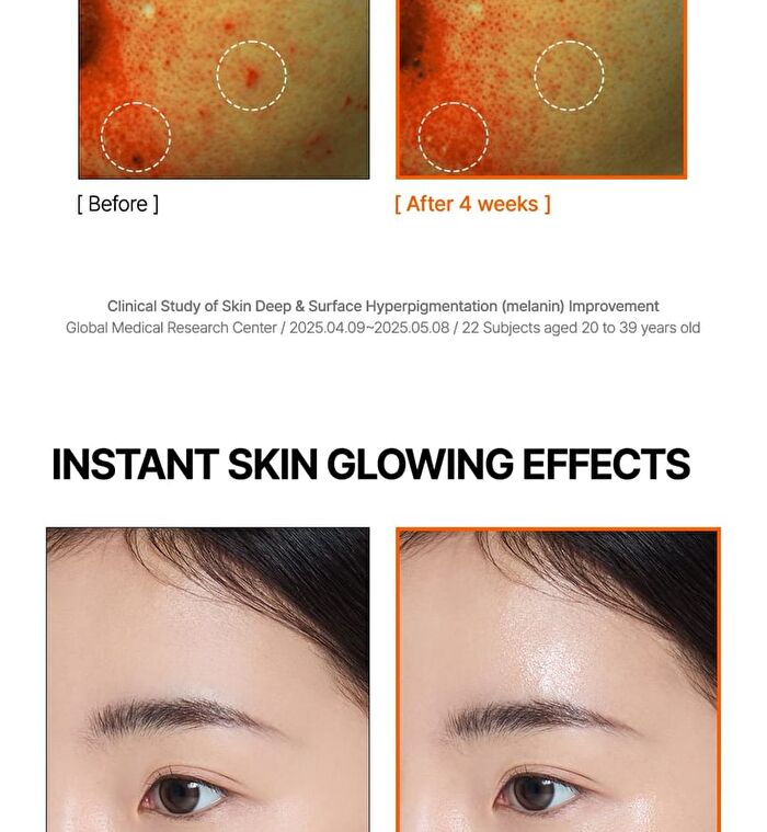 Mandelic Acid Dark Spot Correcting Serum - 30ml