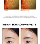 Mandelic Acid Dark Spot Correcting Serum - 30ml