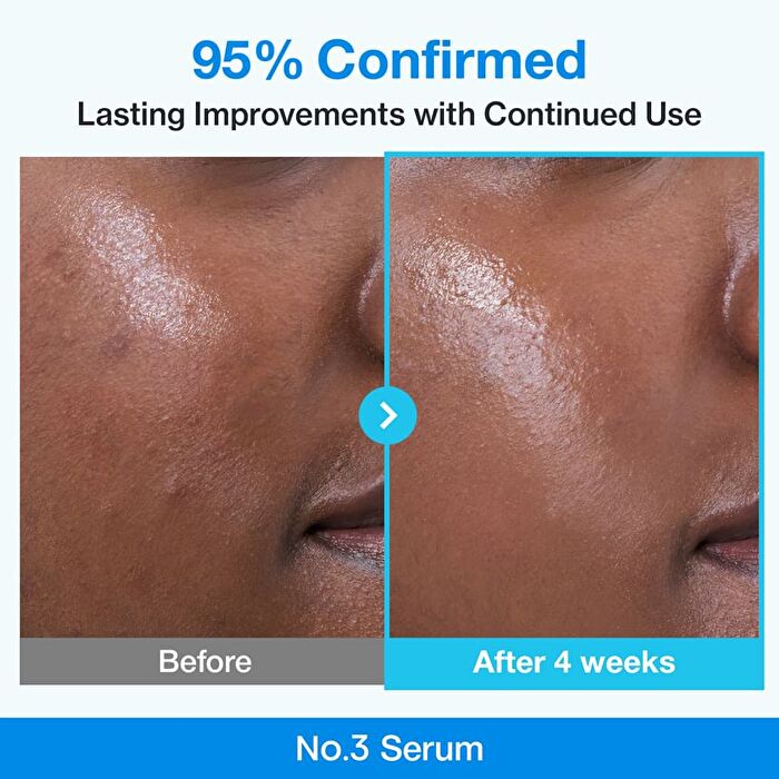 numbuzin No.3 Blue Bio-Retinol Pore Refining Serum - 30ml