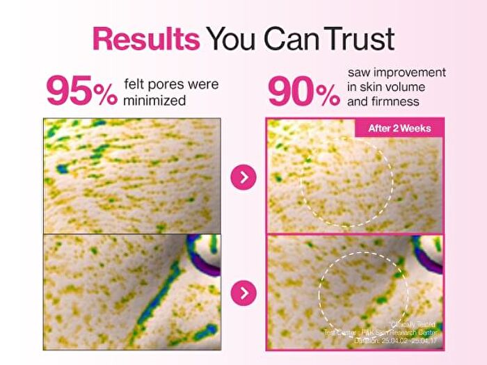numbuzin No.2 Rose PDRN Overnight Collagen Mask Set - 37g x 4 sheets