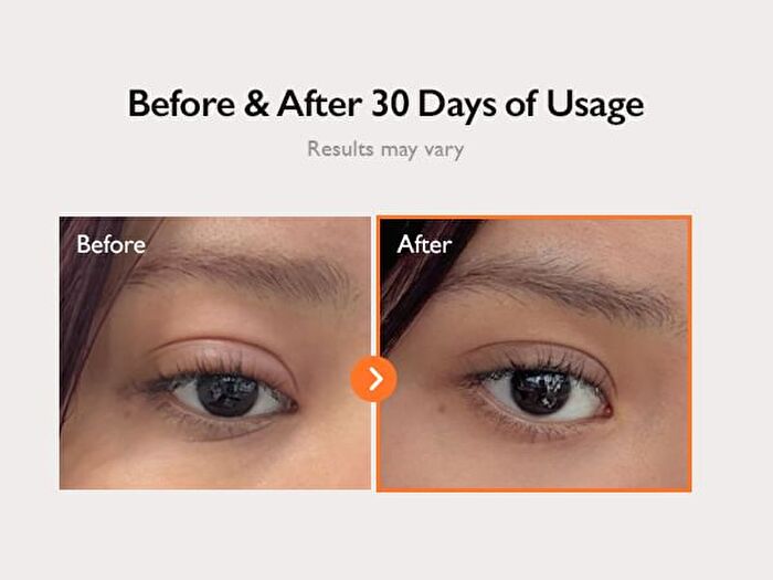 PDRN 360 Rejuvenating Eye Mask - 70 patches