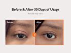 PDRN 360 Rejuvenating Eye Mask - 70 patches