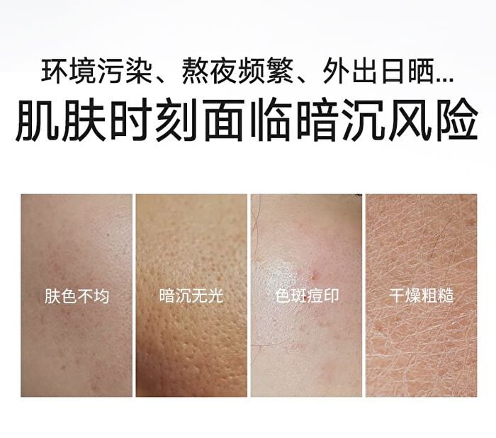 Franic Niacinamide Water Glowing Facial Mask (5pcs) - 25ml x 5pcs