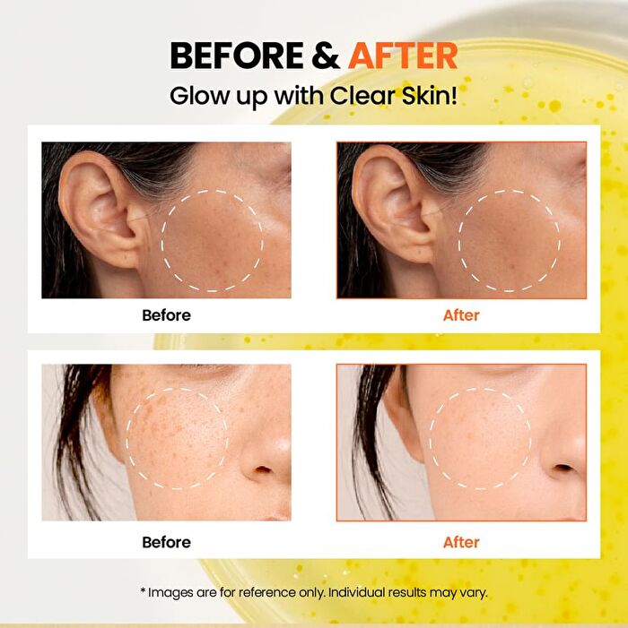 Ksecret SEOUL 1988 Glow Serum : Niacinamide 15% + Yuja - 30ml