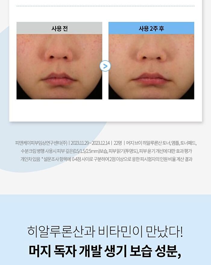 Merzy V-Hyaluron Moisture Toner - 500ml
