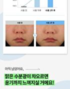 Merzy V-Hyaluron Moisture Ampoule - 100ml