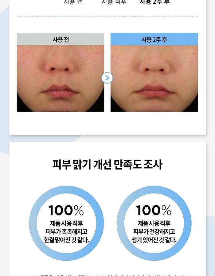 Merzy V-Hyaluron Moisture Cream - 100ml