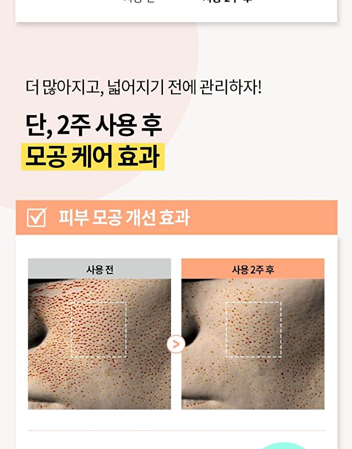 Merzy W-Tomato Niacinamide 10% Cream - 60ml