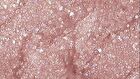 Merzy Windy Pop Eye Glitter - 4 Colors - #PE3 Sweet Paradise
