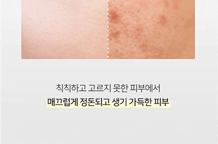 Signature Niacinamide 15% Ampoule - 30ml