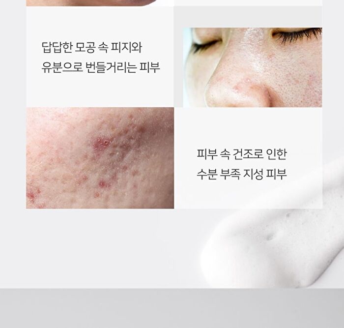 AC+ Teatree Acne Cleansing Foam - 150ml