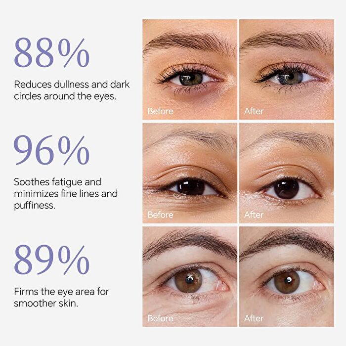 Bakuchiol + Peptides Retinol Eye Concealer Cream - 3 Shades - 01# Light Skin Color - 15g