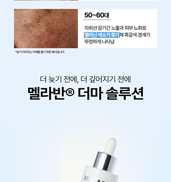 Melaban Serum - 50ml