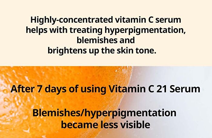 Frankly Vitamin C 23 Pure Vitamin C Boost Serum - 2025 Version - 15ml